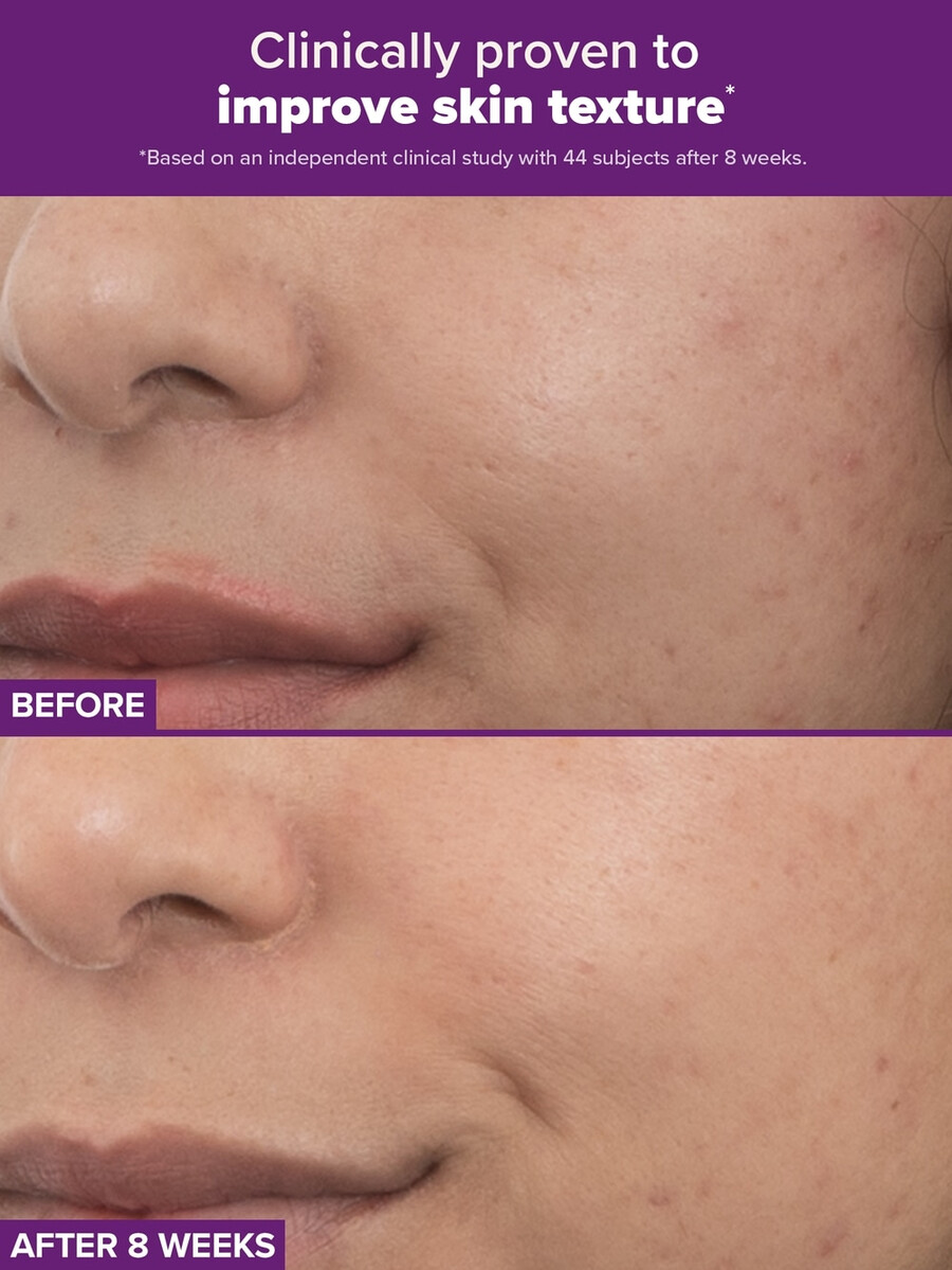 clinical pro retinaldehyd dual-retinoid behandling