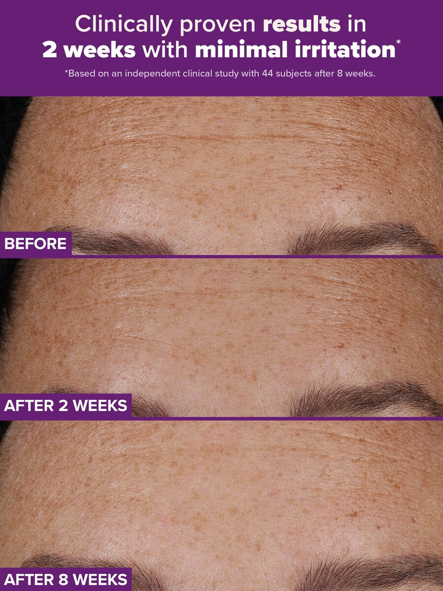 clinical pro retinaldehyd dual-retinoid behandling