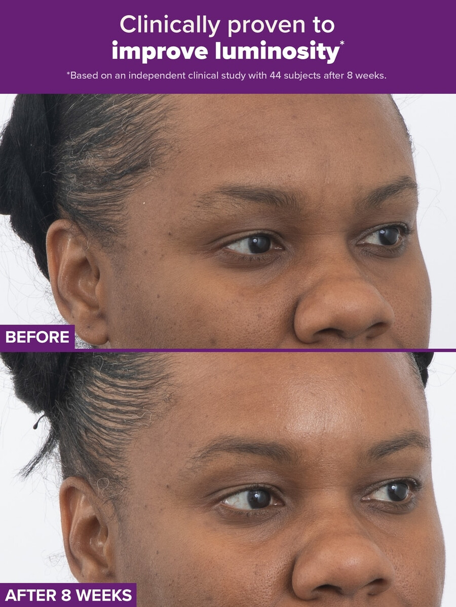 clinical pro retinaldehyd dual-retinoid behandling